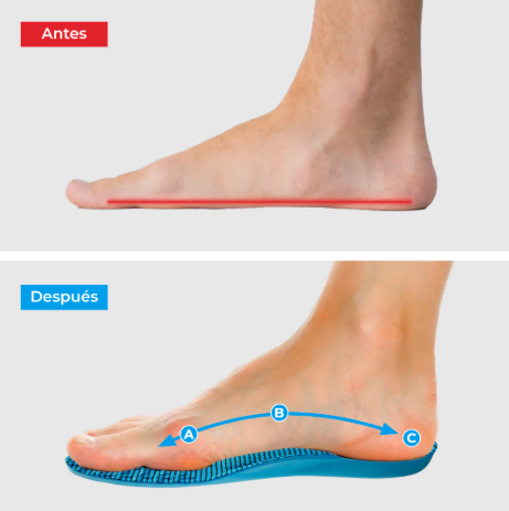 Plantillas ComfyFeet