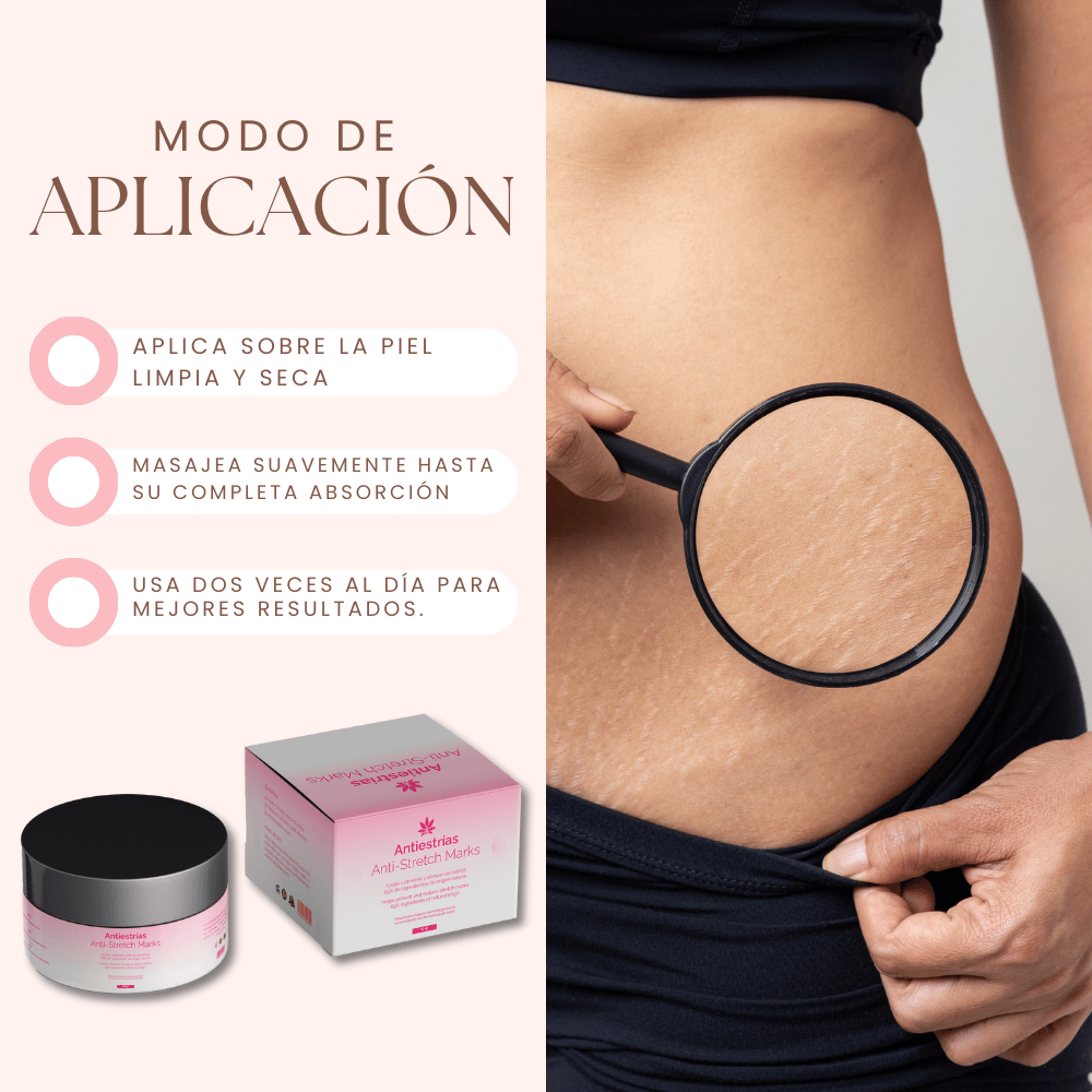CREMA ANTI ESTRÍAS