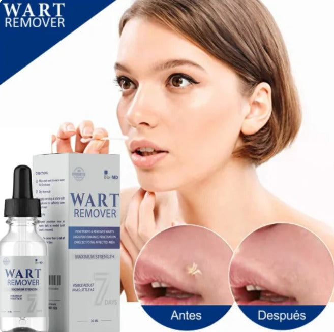 WART REMOVER | REMOVEDOR DE VERRUGAS Y LUNARES