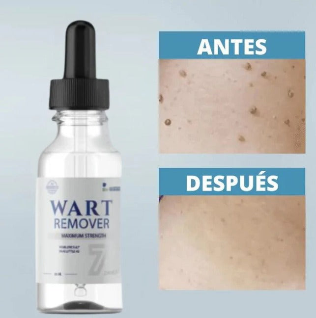 WART REMOVER | REMOVEDOR DE VERRUGAS Y LUNARES